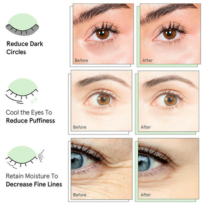 Quia Collagen Eye Patches for Dark Circles & Puffiness
